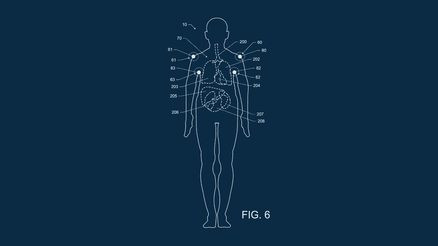 Patent drawing: a body outline with predicted organ positions drawn inside the torso